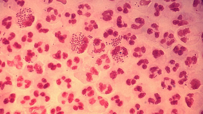 Age-Old Sexually Transmitted Infections That Are Making a Comeback