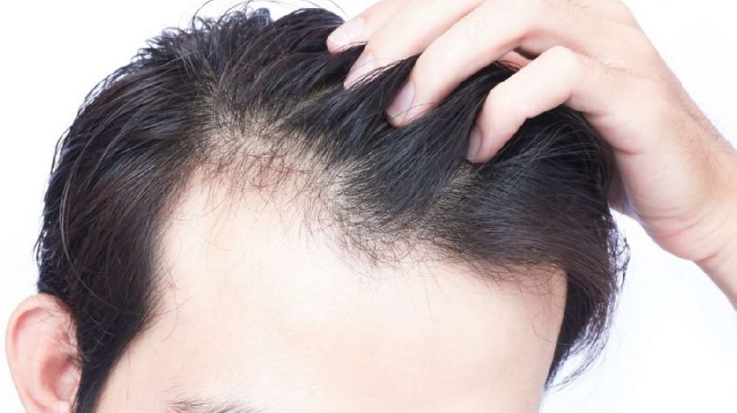 Is there a chance to recover lost hair?
