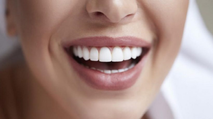 Why is Dental Implants the Best Option Today?
