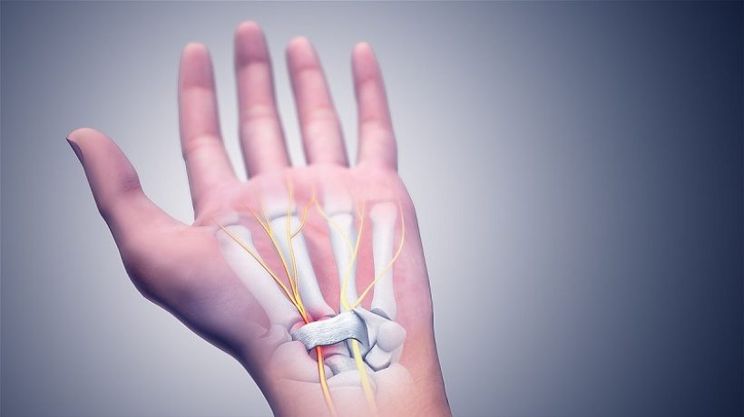 How to prevent carpal tunnel
