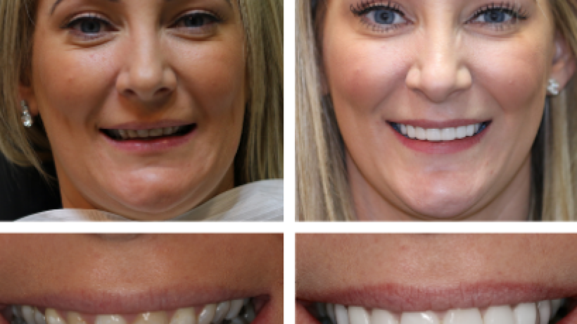 Has cosmetic surgery become too commonplace?