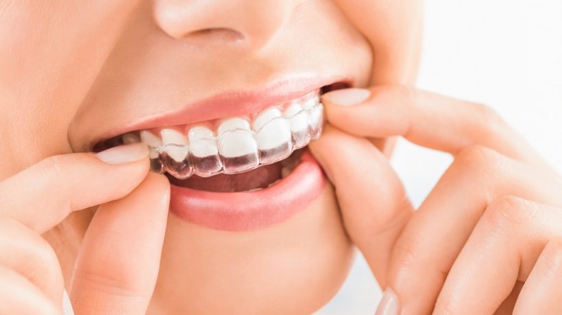 Signs That Indicate You Must Visit A Dentist
