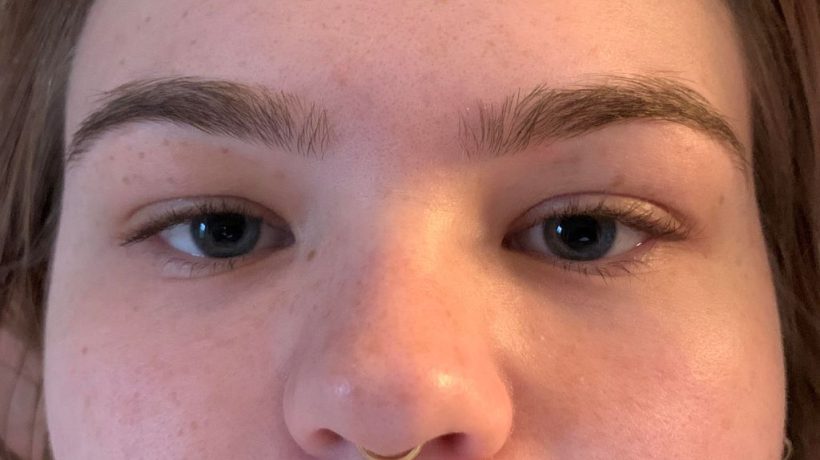 Do Europeans Have Epicanthic Folds?